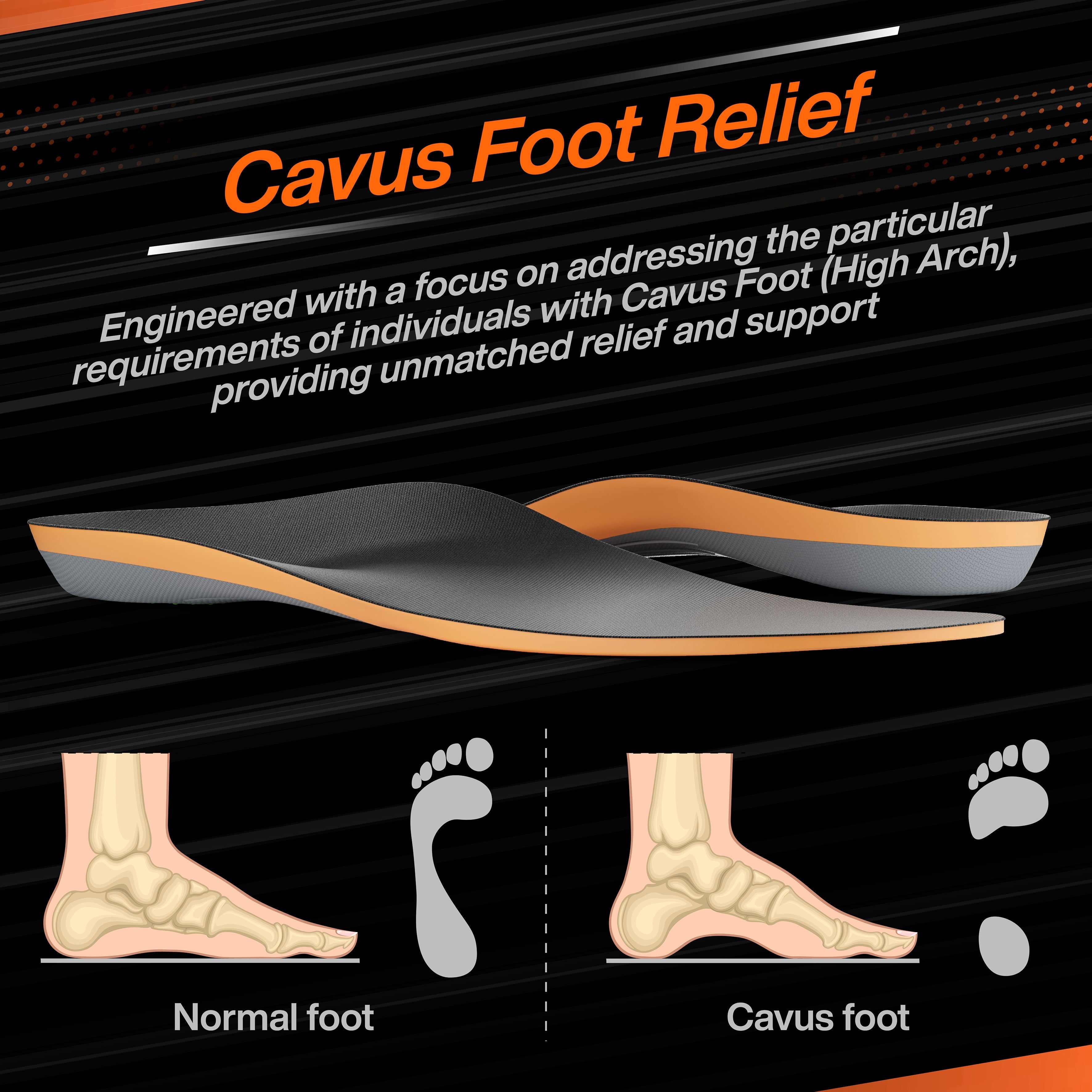High Arch Support PU Insole - Shoe Inserts for High Arch (Cavus Foot), Plantar Fasciitis, Foot Pain & Heel Spurs